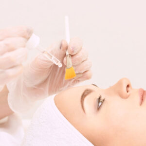 Image Mix Peels